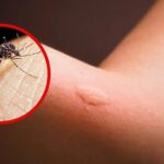 Red de Salud Carabaya solicita laboratorio para desarrollar pruebas de dengue