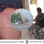 Perro pitbull ataca y deja herido a un joven en la urbanización Taparachi