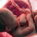 Destacan el Dia del Niño por Nacer que se recuerda hoy y la promoción de la vida