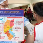 Puno registra 293 casos confirmados de sarampión y Juliaca concentra la mayor cantidad de contagios