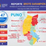 Puno reporta 165 casos confirmados de sarampión y concentra mayor incidencia en Juliaca